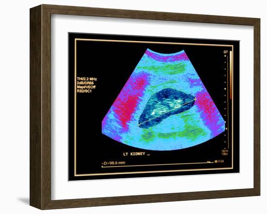 Healthy Kidney Measured, Ultrasound Scan-Science Photo Library-Framed Photographic Print