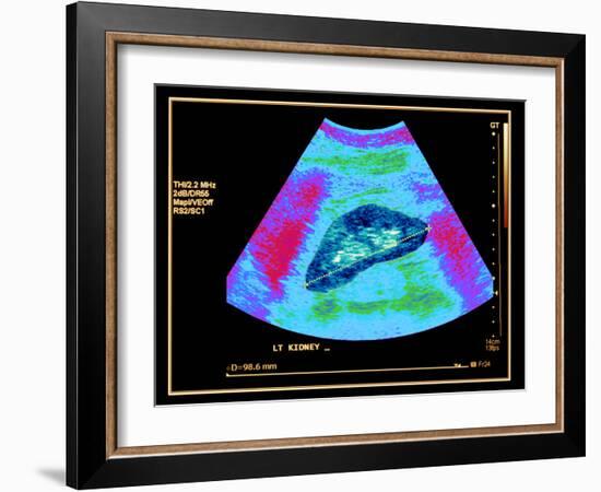 Healthy Kidney Measured, Ultrasound Scan-Science Photo Library-Framed Photographic Print
