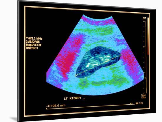 Healthy Kidney Measured, Ultrasound Scan-Science Photo Library-Mounted Photographic Print