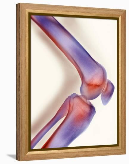 Healthy Knee, X-ray-Science Photo Library-Framed Premier Image Canvas