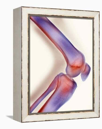 Healthy Knee, X-ray-Science Photo Library-Framed Premier Image Canvas