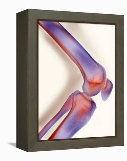 Healthy Knee, X-ray-Science Photo Library-Framed Premier Image Canvas