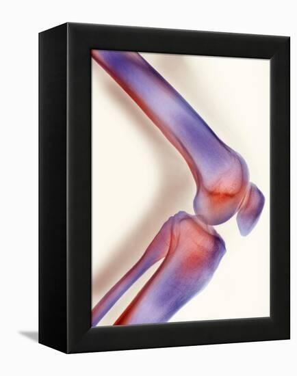 Healthy Knee, X-ray-Science Photo Library-Framed Premier Image Canvas