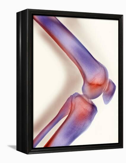 Healthy Knee, X-ray-Science Photo Library-Framed Premier Image Canvas