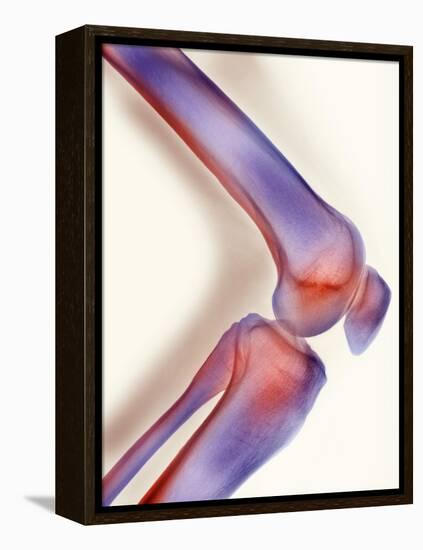 Healthy Knee, X-ray-Science Photo Library-Framed Premier Image Canvas