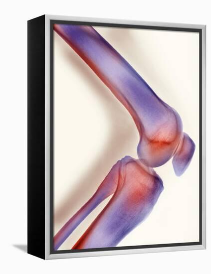 Healthy Knee, X-ray-Science Photo Library-Framed Premier Image Canvas