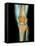 Healthy Knee, X-ray-Science Photo Library-Framed Premier Image Canvas