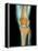 Healthy Knee, X-ray-Science Photo Library-Framed Premier Image Canvas