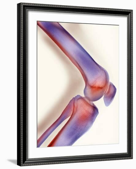 Healthy Knee, X-ray-Science Photo Library-Framed Photographic Print