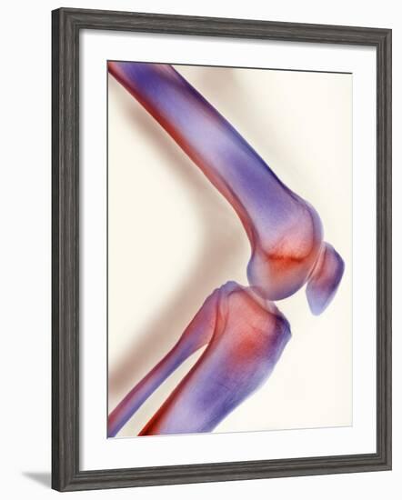 Healthy Knee, X-ray-Science Photo Library-Framed Photographic Print