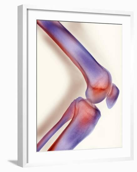 Healthy Knee, X-ray-Science Photo Library-Framed Photographic Print