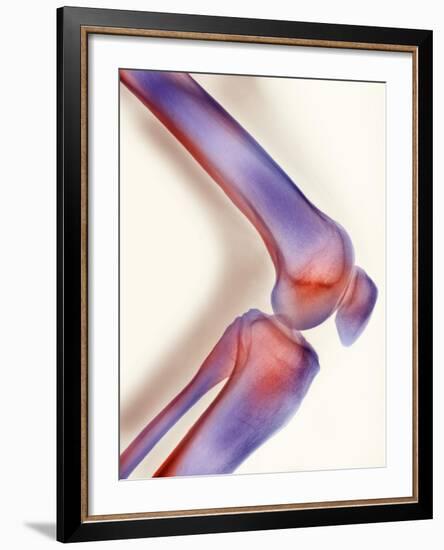 Healthy Knee, X-ray-Science Photo Library-Framed Photographic Print