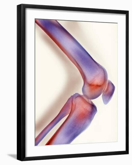 Healthy Knee, X-ray-Science Photo Library-Framed Photographic Print