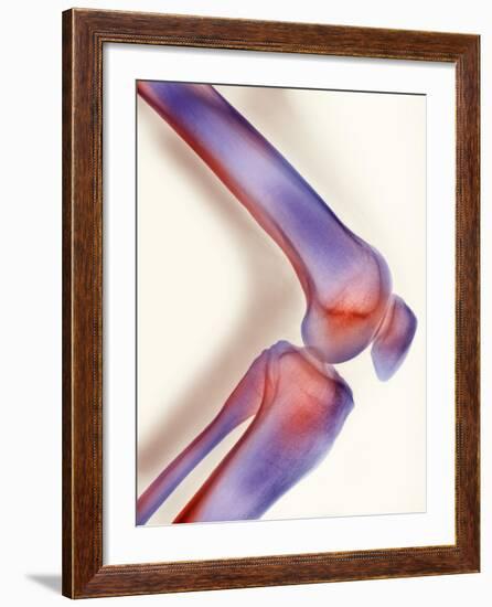 Healthy Knee, X-ray-Science Photo Library-Framed Photographic Print