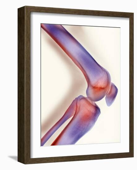 Healthy Knee, X-ray-Science Photo Library-Framed Photographic Print