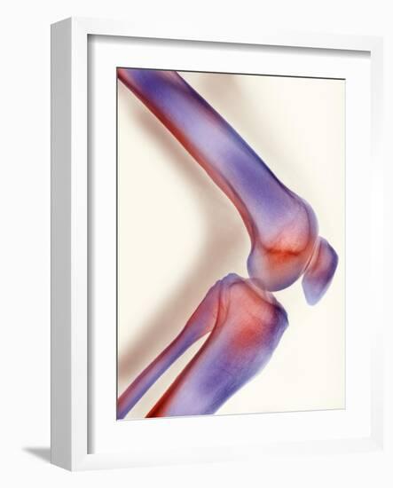 Healthy Knee, X-ray-Science Photo Library-Framed Photographic Print