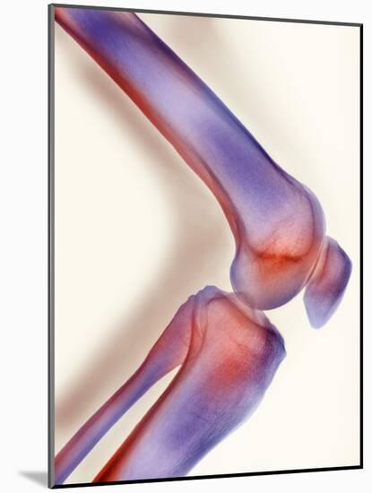 Healthy Knee, X-ray-Science Photo Library-Mounted Photographic Print