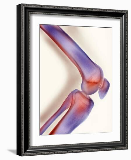 Healthy Knee, X-ray-Science Photo Library-Framed Photographic Print