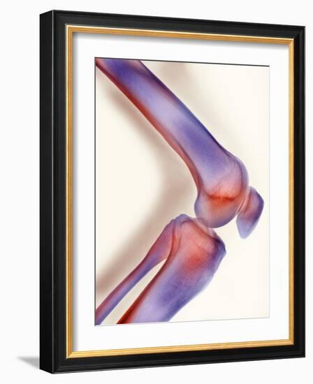 Healthy Knee, X-ray-Science Photo Library-Framed Photographic Print