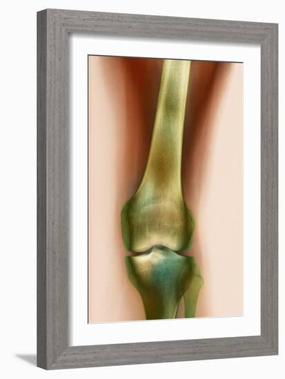 Healthy Knee, X-ray-Science Photo Library-Framed Photographic Print