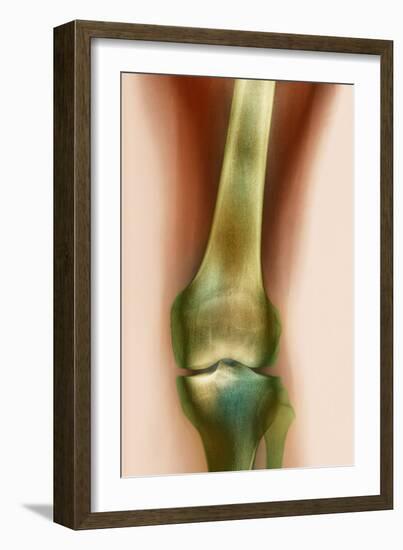 Healthy Knee, X-ray-Science Photo Library-Framed Photographic Print