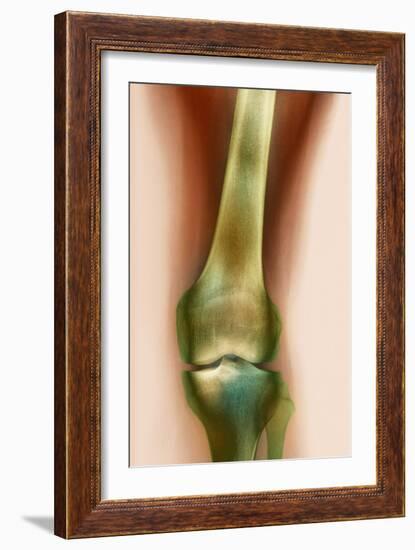 Healthy Knee, X-ray-Science Photo Library-Framed Photographic Print