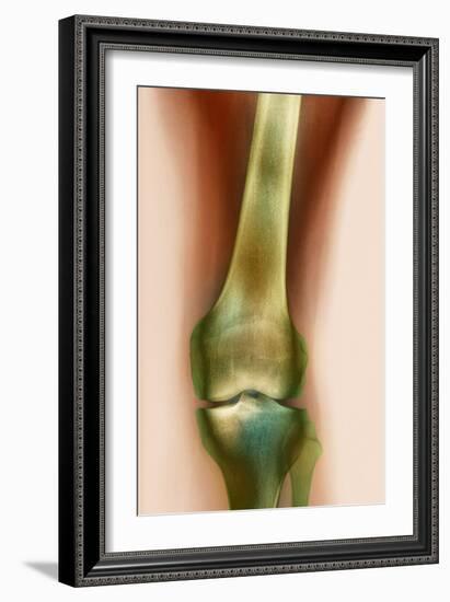 Healthy Knee, X-ray-Science Photo Library-Framed Photographic Print