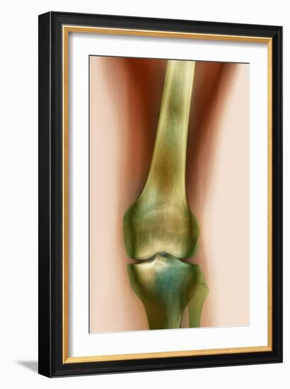 Healthy Knee, X-ray-Science Photo Library-Framed Photographic Print