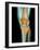 Healthy Knee, X-ray-Science Photo Library-Framed Photographic Print