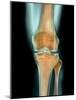 Healthy Knee, X-ray-Science Photo Library-Mounted Photographic Print