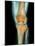 Healthy Knee, X-ray-Science Photo Library-Mounted Photographic Print