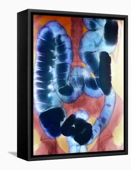 Healthy Large Intestine, Barium X-ray-Science Photo Library-Framed Premier Image Canvas