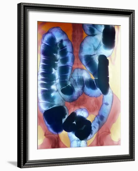 Healthy Large Intestine, Barium X-ray-Science Photo Library-Framed Photographic Print