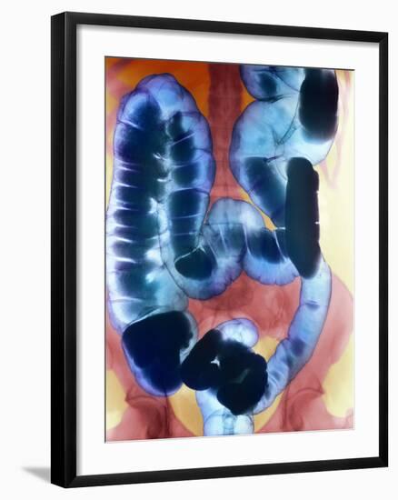 Healthy Large Intestine, Barium X-ray-Science Photo Library-Framed Photographic Print