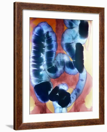 Healthy Large Intestine, Barium X-ray-Science Photo Library-Framed Photographic Print