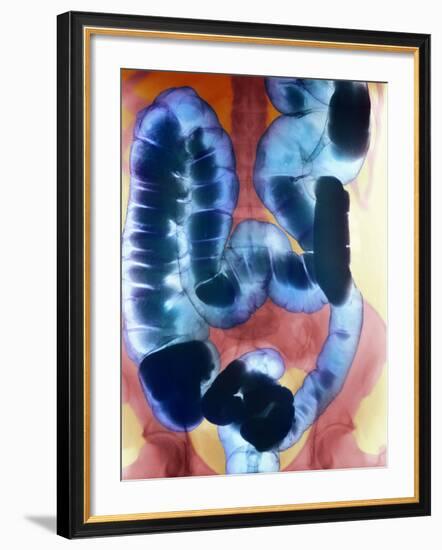 Healthy Large Intestine, Barium X-ray-Science Photo Library-Framed Photographic Print