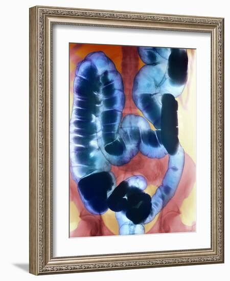 Healthy Large Intestine, Barium X-ray-Science Photo Library-Framed Photographic Print