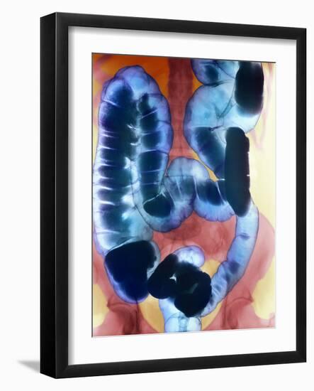 Healthy Large Intestine, Barium X-ray-Science Photo Library-Framed Photographic Print