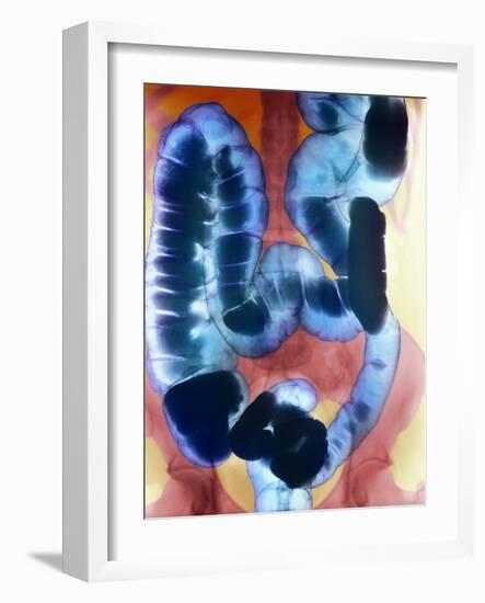 Healthy Large Intestine, Barium X-ray-Science Photo Library-Framed Photographic Print