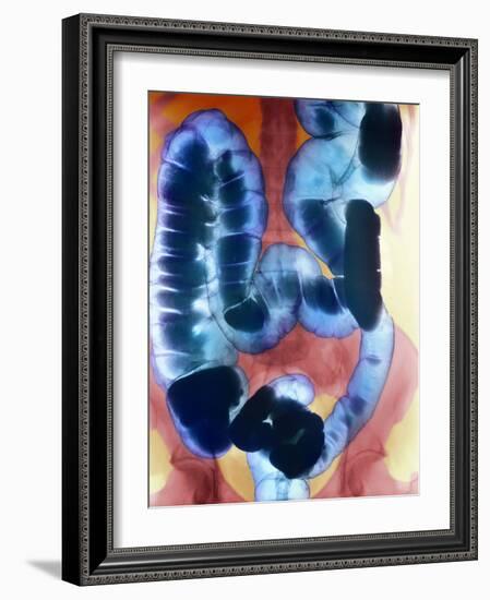 Healthy Large Intestine, Barium X-ray-Science Photo Library-Framed Photographic Print