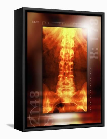 Healthy Lower Back, X-ray-Miriam Maslo-Framed Premier Image Canvas