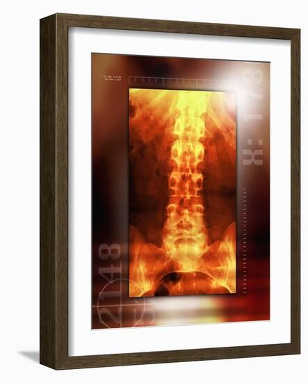 Healthy Lower Back, X-ray-Miriam Maslo-Framed Photographic Print