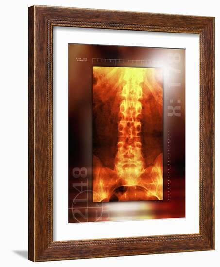 Healthy Lower Back, X-ray-Miriam Maslo-Framed Photographic Print