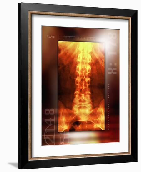 Healthy Lower Back, X-ray-Miriam Maslo-Framed Photographic Print