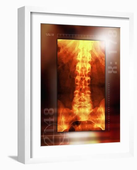 Healthy Lower Back, X-ray-Miriam Maslo-Framed Photographic Print