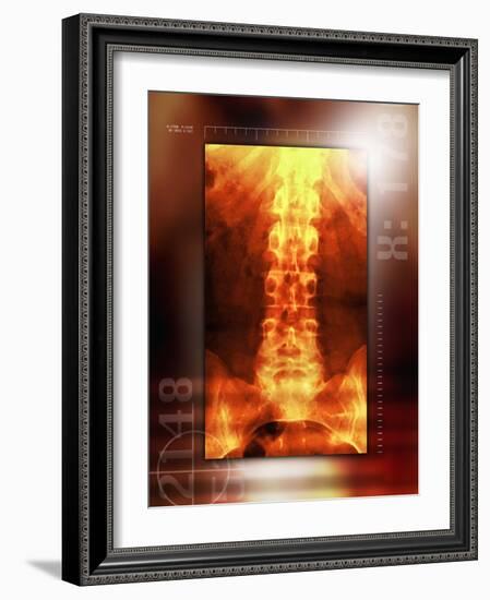 Healthy Lower Back, X-ray-Miriam Maslo-Framed Photographic Print