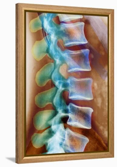 Healthy Lower Spine, X-ray-Science Photo Library-Framed Premier Image Canvas