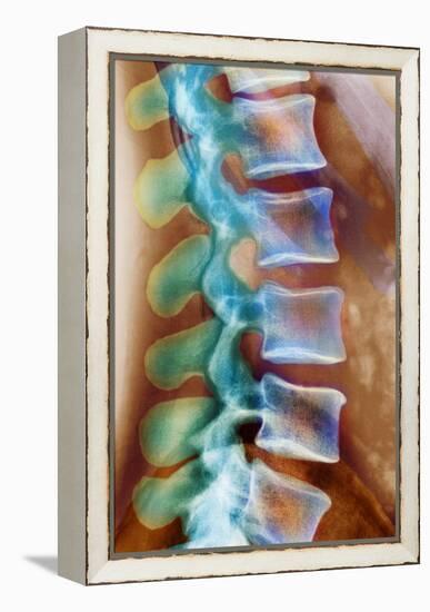 Healthy Lower Spine, X-ray-Science Photo Library-Framed Premier Image Canvas