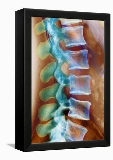 Healthy Lower Spine, X-ray-Science Photo Library-Framed Premier Image Canvas