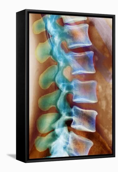Healthy Lower Spine, X-ray-Science Photo Library-Framed Premier Image Canvas